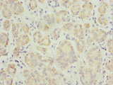 TPD52L1 Antibody - Immunohistochemistry of paraffin-embedded human salivary gland tissue at dilution 1:100