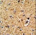 TPH1 / Tryptophan Hydroxylase Antibody - Formalin-fixed and paraffin-embedded human brain tissue with TPH1 Antibody , which was peroxidase-conjugated to the secondary antibody, followed by DAB staining. This data demonstrates the use of this antibody for immunohistochemistry; clinical relevance has not been evaluated.