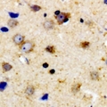 TPH1 / Tryptophan Hydroxylase Antibody - Immunohistochemical analysis of TPH1 (pS58) staining in human brain formalin fixed paraffin embedded tissue section. The section was pre-treated using heat mediated antigen retrieval with sodium citrate buffer (pH 6.0). The section was then incubated with the antibody at room temperature and detected using an HRP conjugated compact polymer system. DAB was used as the chromogen. The section was then counterstained with haematoxylin and mounted with DPX.