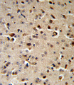 TPH2 Antibody - TPH2 Antibody IHC of formalin-fixed and paraffin-embedded mouse brain followed by peroxidase-conjugated secondary antibody and DAB staining.
