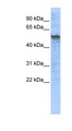 TPH2 Antibody - TPH2 antibody Western blot of Fetal Brain lysate. This image was taken for the unconjugated form of this product. Other forms have not been tested.