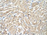 TPM1 / Tropomyosin Antibody - TPM1 / Tropomyosin antibody ARP41392_T100-NP_000357-TPM1(tropomyosin 1 (alpha)) Antibody was used in IHC to stain formalin-fixed, paraffin-embedded human muscle.  This image was taken for the unconjugated form of this product. Other forms have not been tested.