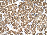 TPM2 Antibody - TPM2 antibody TPM2(tropomyosin 2 (beta)) Antibody was used in IHC to stain formalin-fixed, paraffin-embedded human muscle.  This image was taken for the unconjugated form of this product. Other forms have not been tested.