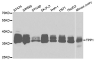 TPP1 / CLN2 Antibody - Western blot analysis of extracts of various cell lines.