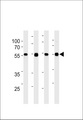 TPTE2 Antibody - TPIPb Antibody western blot of 293,A431,A2058,mouse NIH/3T3 cell line lysates (35 ug/lane). The TPIPb antibody detected the TPIPb protein (arrow).