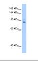 TPX2 Antibody - 721_B cell lysate. Antibody concentration: 0.5 ug/ml. Gel concentration: 12%.  This image was taken for the unconjugated form of this product. Other forms have not been tested.