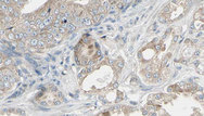 TRAF1 Antibody - 1:100 staining human prostate tissue by IHC-P. The sample was formaldehyde fixed and a heat mediated antigen retrieval step in citrate buffer was performed. The sample was then blocked and incubated with the antibody for 1.5 hours at 22°C. An HRP conjugated goat anti-rabbit antibody was used as the secondary.