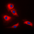 TRAF3 Antibody - Immunofluorescent analysis of TRAF3 staining in HeLa cells. Formalin-fixed cells were permeabilized with 0.1% Triton X-100 in TBS for 5-10 minutes and blocked with 3% BSA-PBS for 30 minutes at room temperature. Cells were probed with the primary antibody in 3% BSA-PBS and incubated overnight at 4 C in a humidified chamber. Cells were washed with PBST and incubated with a DyLight 594-conjugated secondary antibody (red) in PBS at room temperature in the dark. DAPI was used to stain the cell nuclei (blue).
