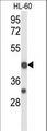 TRAIL-R4 / DCR2 Antibody - Western blot of TNFRSF10D Antibody in HL-60 cell line lysates (35 ug/lane). TNFRSF10D (arrow) was detected using the purified antibody.