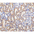 TRAIL-R4 / DCR2 Antibody - Immunohistochemistry of DcR2 in mouse kidney node tissue with DcR2 antibody at 2.5 µg/ml.