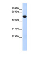 TRAM1L1 Antibody - TRAM1L1 antibody Western blot of Fetal liver lysate. This image was taken for the unconjugated form of this product. Other forms have not been tested.