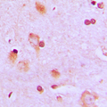 Translokin / CEP57 Antibody - Immunohistochemical analysis of CEP57 staining in human brain formalin fixed paraffin embedded tissue section. The section was pre-treated using heat mediated antigen retrieval with sodium citrate buffer (pH 6.0). The section was then incubated with the antibody at room temperature and detected using an HRP conjugated compact polymer system. DAB was used as the chromogen. The section was then counterstained with hematoxylin and mounted with DPX.