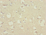 Translokin / CEP57 Antibody - Immunohistochemistry of paraffin-embedded human brain tissue at dilution of 1:100
