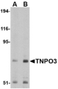 Transportin-SR / TNPO3 Antibody - Western blot of TNPO3 in Raji cell lysate with TNPO3 antibody at (A) 1 and (B) 2 ug/ml.