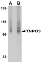Transportin-SR / TNPO3 Antibody - Western blot of TNPO3 in rat liver tissue lysate with TNPO3 antibody at (A) 1 and (B) 2 ug/ml.