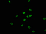 TRAPPC11 Antibody - Immunofluorescence staining of U251 cells with TRAPPC11 Antibody at 1:100, counter-stained with DAPI. The cells were fixed in 4% formaldehyde, permeabilized using 0.2% Triton X-100 and blocked in 10% normal Goat Serum. The cells were then incubated with the antibody overnight at 4°C. The secondary antibody was Alexa Fluor 488-congugated AffiniPure Goat Anti-Rabbit IgG(H+L).