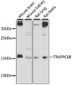 TRAPPC6B Antibody - Western blot analysis of extracts of various cell lines, using TRAPPC6B antibody at 1:1000 dilution. The secondary antibody used was an HRP Goat Anti-Rabbit IgG (H+L) at 1:10000 dilution. Lysates were loaded 25ug per lane and 3% nonfat dry milk in TBST was used for blocking. An ECL Kit was used for detection and the exposure time was 90s.