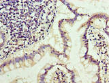 TRBC1 Antibody - Immunohistochemistry of paraffin-embedded human small intestine tissue using TRBC1 Antibody at dilution of 1:100