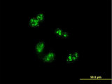Treacle / TCOF1 Antibody - Immunofluorescence of monoclonal antibody to TCOF1 on HeLa cell . [antibody concentration 10 ug/ml]