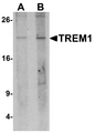 TREM1 Antibody - Western blot analysis of TREM1 in 293 cell lysate with TREM1 antibody at (A) 1 and (B) 2 ug/ml.