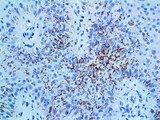 Treponema pallidum Antibody - IHC of Treponema pallidum on an FFPE Infected Skin Tissue