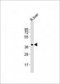 TREX2 Antibody - Anti-Trex2 Antibody at 1:1000 dilution + rat liver lysates Lysates/proteins at 20 ug per lane. Secondary Goat Anti-Rabbit IgG, (H+L), Peroxidase conjugated at 1/10000 dilution Predicted band size : 26 kDa Blocking/Dilution buffer: 5% NFDM/TBST.