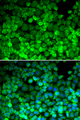 TRF1 / TERF1 Antibody - Immunofluorescence analysis of HeLa cells.