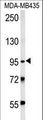 TRHDE Antibody - TRHDE Antibody western blot of MDA-MB435 cell line lysates (15 ug/lane). The TRHDE antibody detected the TRHDE protein (arrow).