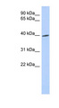 TRIB1 Antibody - TRIB1 antibody Western blot of Fetal Intestine lysate. This image was taken for the unconjugated form of this product. Other forms have not been tested.
