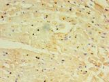TRIM11 Antibody - Immunohistochemistry of paraffin-embedded human heart tissue using antibody at 1:100 dilution.  This image was taken for the unconjugated form of this product. Other forms have not been tested.