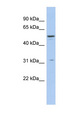 TRIM14 Antibody - TRIM14 antibody Western blot of THP-1 cell lysate. This image was taken for the unconjugated form of this product. Other forms have not been tested.