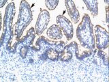 TRIM15 Antibody - TRIM15 antibody ARP34645_T100-NP_150232-TRIM15 (tripartite motif-containing 15) Antibody was used in IHC to stain formalin-fixed, paraffin-embedded human intestine.  This image was taken for the unconjugated form of this product. Other forms have not been tested.