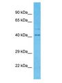 TRIM16L Antibody - TRIM16L antibody Western Blot of Fetal Lung. Antibody dilution: 1 ug/ml.  This image was taken for the unconjugated form of this product. Other forms have not been tested.