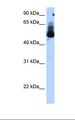 TRIM21 / RO52 Antibody - Transfected 293T cell lysate. Antibody concentration: 1.25 ug/ml. Gel concentration: 12%.  This image was taken for the unconjugated form of this product. Other forms have not been tested.