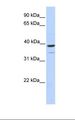 TRIM27 Antibody - Fetal muscle lysate. Antibody concentration: 1.0 ug/ml. Gel concentration: 12%.  This image was taken for the unconjugated form of this product. Other forms have not been tested.
