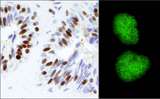 TRIM28 / KAP1 Antibody - Detection of Human KAP-1 by Immunohistochemistry and Immunocytochemistry. Sample: FFPE section of human prostate carcinoma (left) and formaldelyde-fixed HeLa cells (right). Antibody: Affinity purified rabbit anti-KAP-1 used at a dilution of 1:1000 (1&#956;g/ml). Detection: DAB (left) and green fluorescent goat anti-rabbit IgG highly cross-adsorbed Antibody FITC conjugated used at a dilution of 1:100 (right).