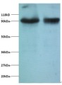 TRIM28 / KAP1 Antibody - Western blot of Transcription intermediary factor 1-beta antibody at 2 ug/ml. Lane 1: EC109 whole cell lysate. Lane 2: 293T whole cell lysate. Secondary: Goat polyclonal to Rabbit IgG at 1:15000 dilution. Predicted band size: 92 kDa. Observed band size: 92 kDa.  This image was taken for the unconjugated form of this product. Other forms have not been tested.