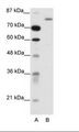TRIM28 / KAP1 Antibody - A: Marker, B: HepG2 Cell Lysate.  This image was taken for the unconjugated form of this product. Other forms have not been tested.