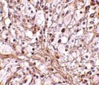 Trim30 Antibody - Immunohistochemistry of TRIM30 in mouse ovary tissue with TRIM30 antibody at 10 ug/ml.