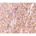 Trim30 Antibody - Immunohistochemistry of TRIM30 in mouse ovary tissue with TRIM30 antibody at 10 µg/mL.