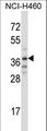TRIM31 / RNF Antibody - TRIM31 Antibody western blot of NCI-H460 cell line lysates (35 ug/lane). The TRIM31 antibody detected the TRIM31 protein (arrow).