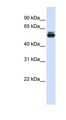 TRIM35 Antibody - TRIM35 antibody Western blot of Fetal Muscle lysate. This image was taken for the unconjugated form of this product. Other forms have not been tested.