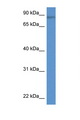 TRIM36 Antibody - TRIM36 antibody Western blot of Rat Lung lysate. Antibody concentration 1 ug/ml.  This image was taken for the unconjugated form of this product. Other forms have not been tested.