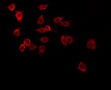 TRIM38 Antibody - Staining LOVO cells by IF/ICC. The samples were fixed with PFA and permeabilized in 0.1% Triton X-100, then blocked in 10% serum for 45 min at 25°C. The primary antibody was diluted at 1:200 and incubated with the sample for 1 hour at 37°C. An Alexa Fluor 594 conjugated goat anti-rabbit IgG (H+L) Ab, diluted at 1/600, was used as the secondary antibody.