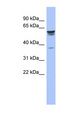 TRIM4 / RNF87 Antibody - TRIM4 / RNF87 antibody Western blot of Fetal Stomach lysate. This image was taken for the unconjugated form of this product. Other forms have not been tested.