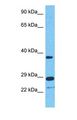 TRIM40 Antibody - Western blot of TRI40 Antibody with human Jurkat Whole Cell lysate.  This image was taken for the unconjugated form of this product. Other forms have not been tested.
