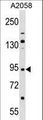 TRIM42 Antibody - TRIM42 Antibody western blot of A2058 cell line lysates (35 ug/lane). The TRIM42 antibody detected the TRIM42 protein (arrow).