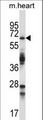 TRIM45 Antibody - TRIM45 Antibody western blot of mouse heart tissue lysates (35 ug/lane). The TRIM45 antibody detected the TRIM45 protein (arrow).