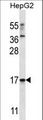 TRIM48 / RNF101 Antibody - TRIM48 Antibody western blot of HepG2 cell line lysates (35 ug/lane). The TRIM48 antibody detected the TRIM48 protein (arrow).
