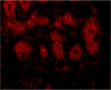 TRIM5 Antibody - Immunofluorescence of TRIM5a in human breast tissue with TRIM5a antibody at 10 µg/ml.